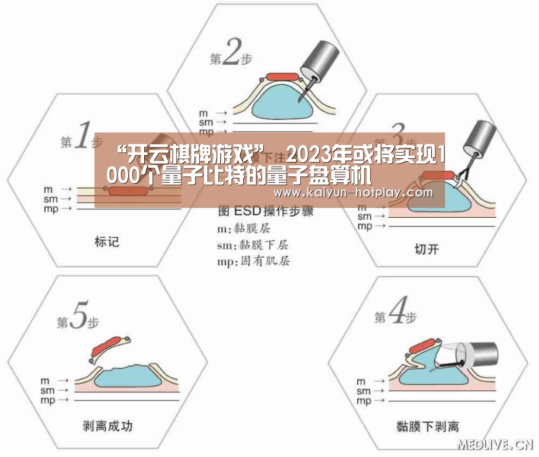 “开云棋牌游戏”
2023年或将实现1000个量子比特的量子盘算机(图3) 开云电竞
